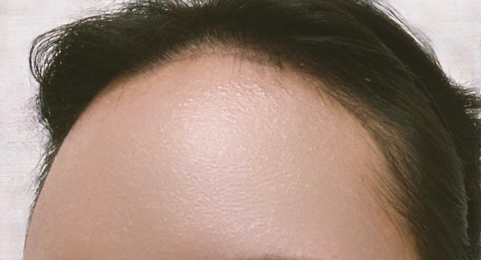 수술후기이미지