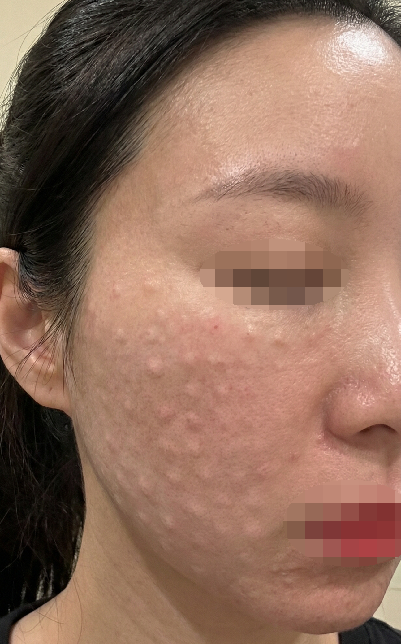 수술후기이미지