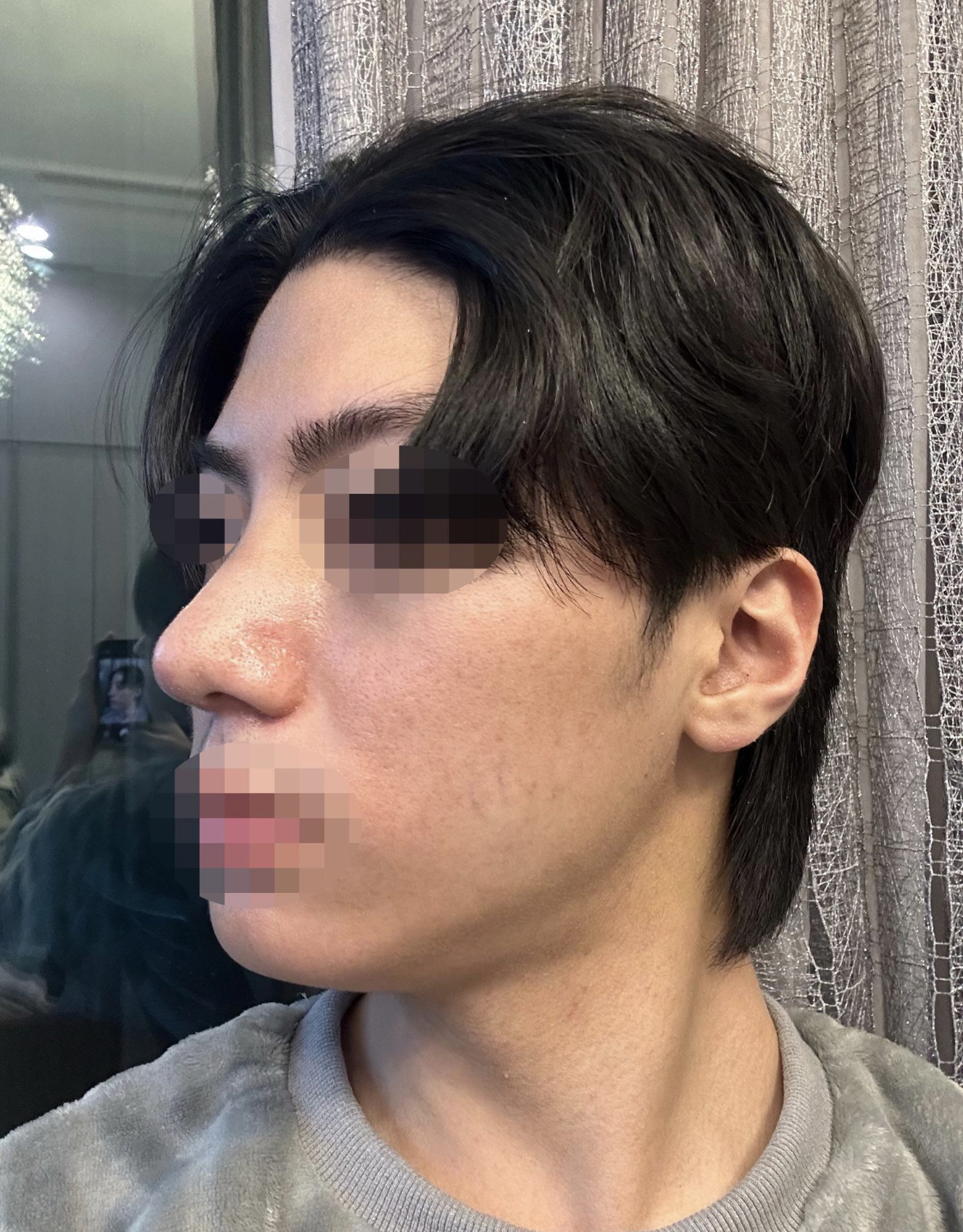 수술후기이미지