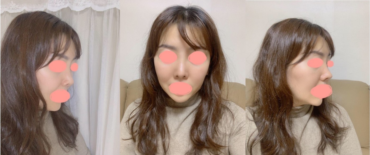 수술후기이미지