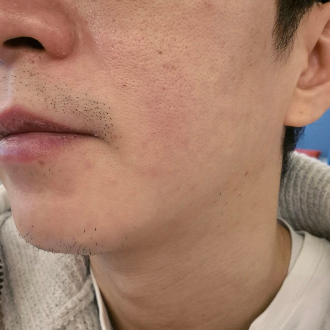 수술후기이미지