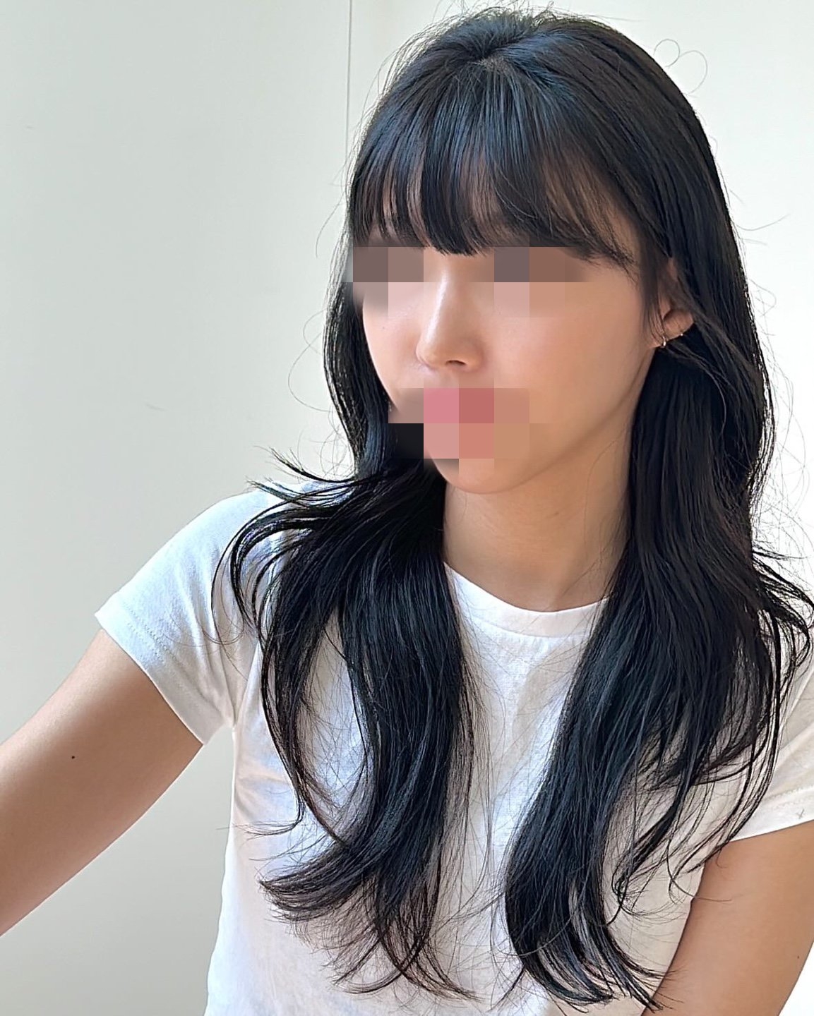 수술후기이미지