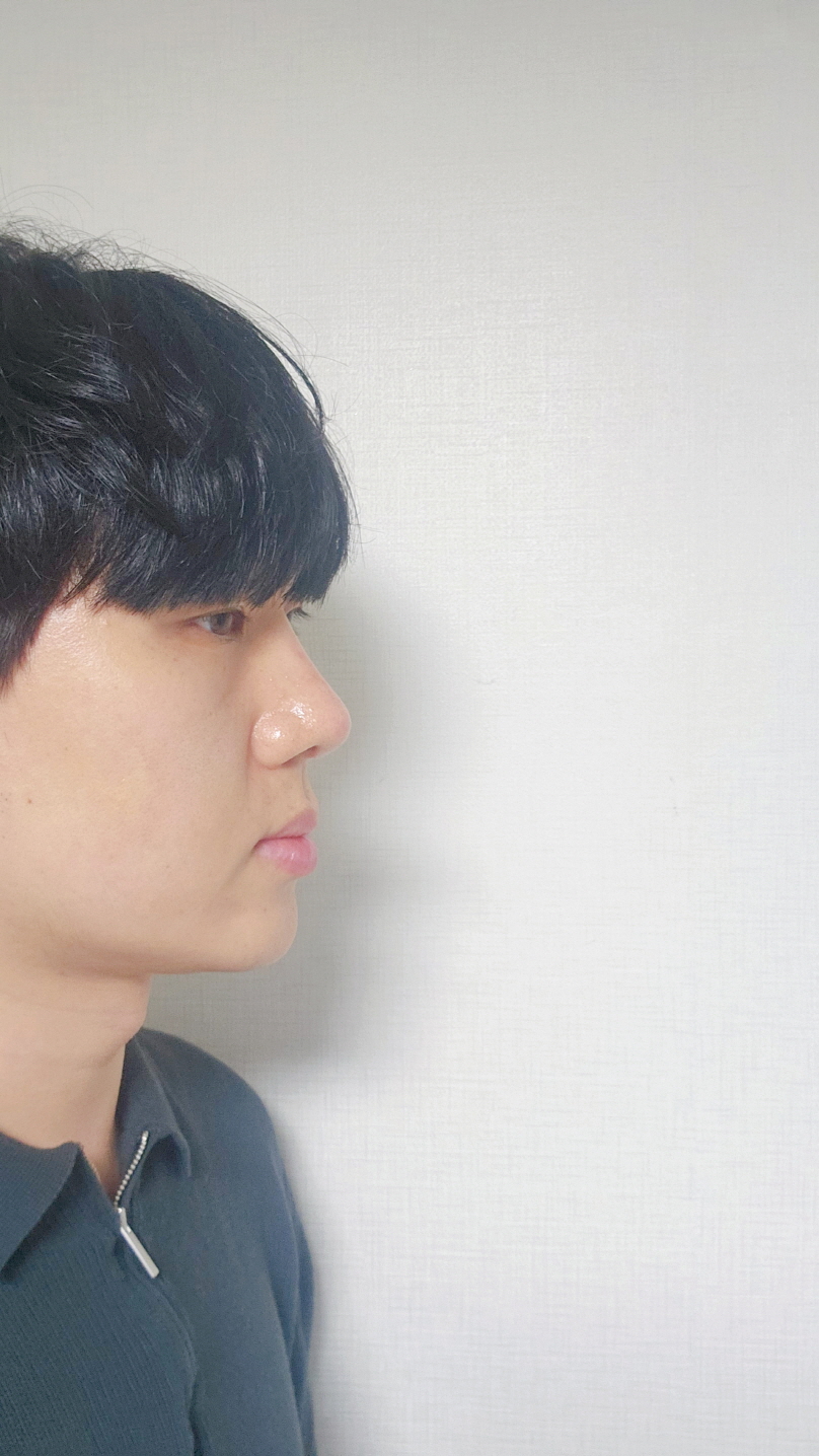 수술후기이미지