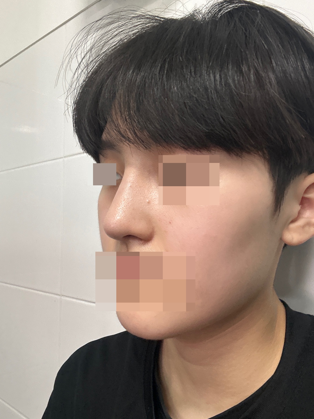 수술후기이미지