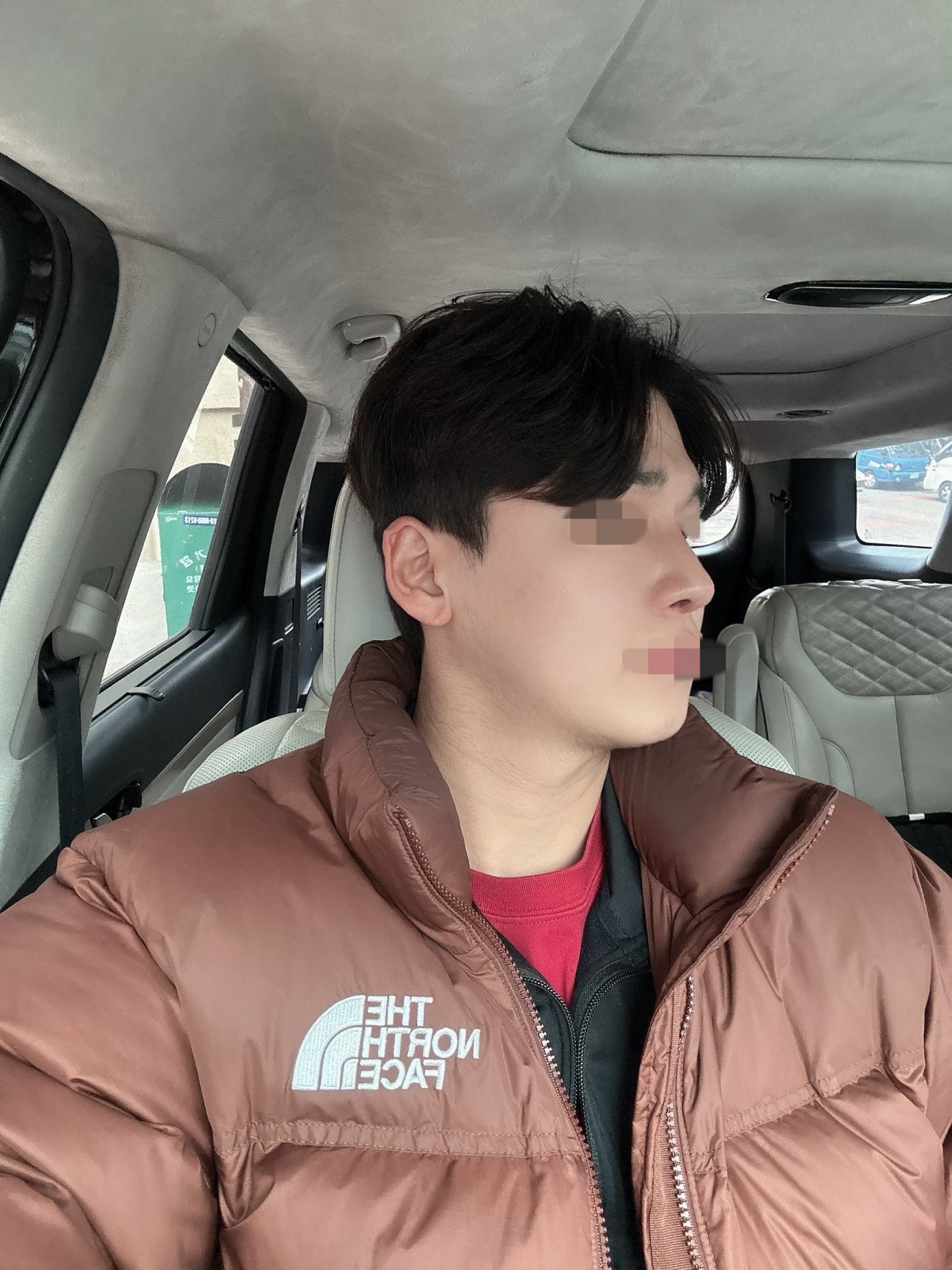 수술후기이미지