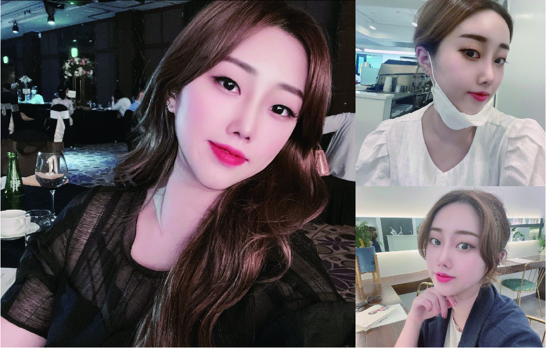 수술후기이미지