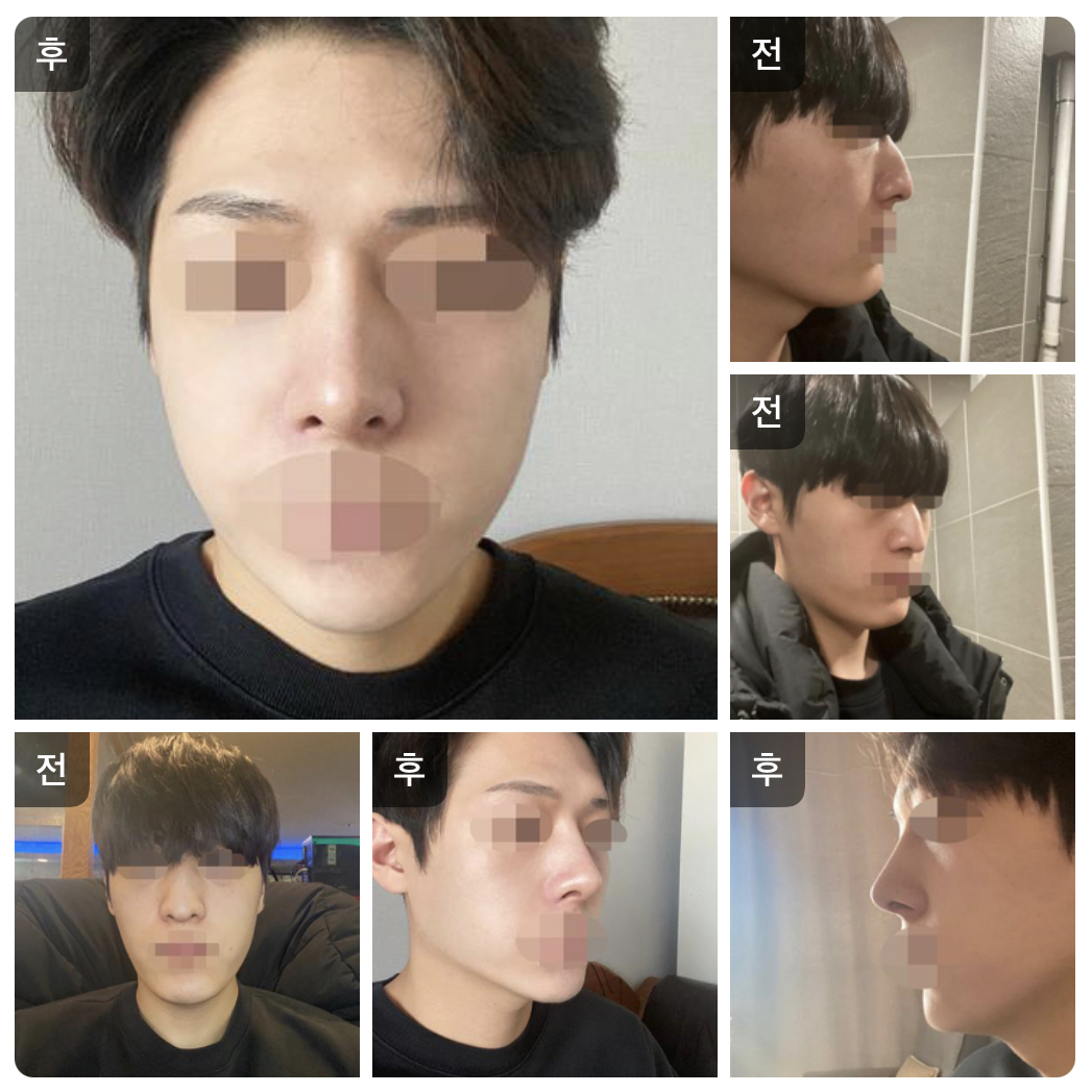 수술후기이미지