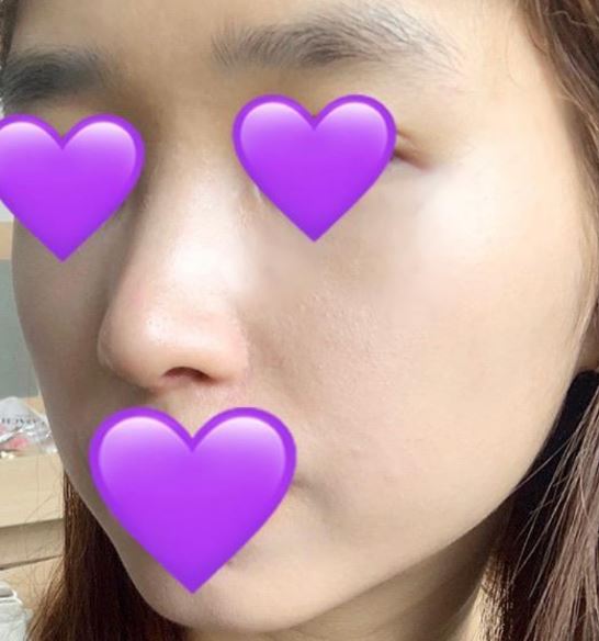 수술후기이미지