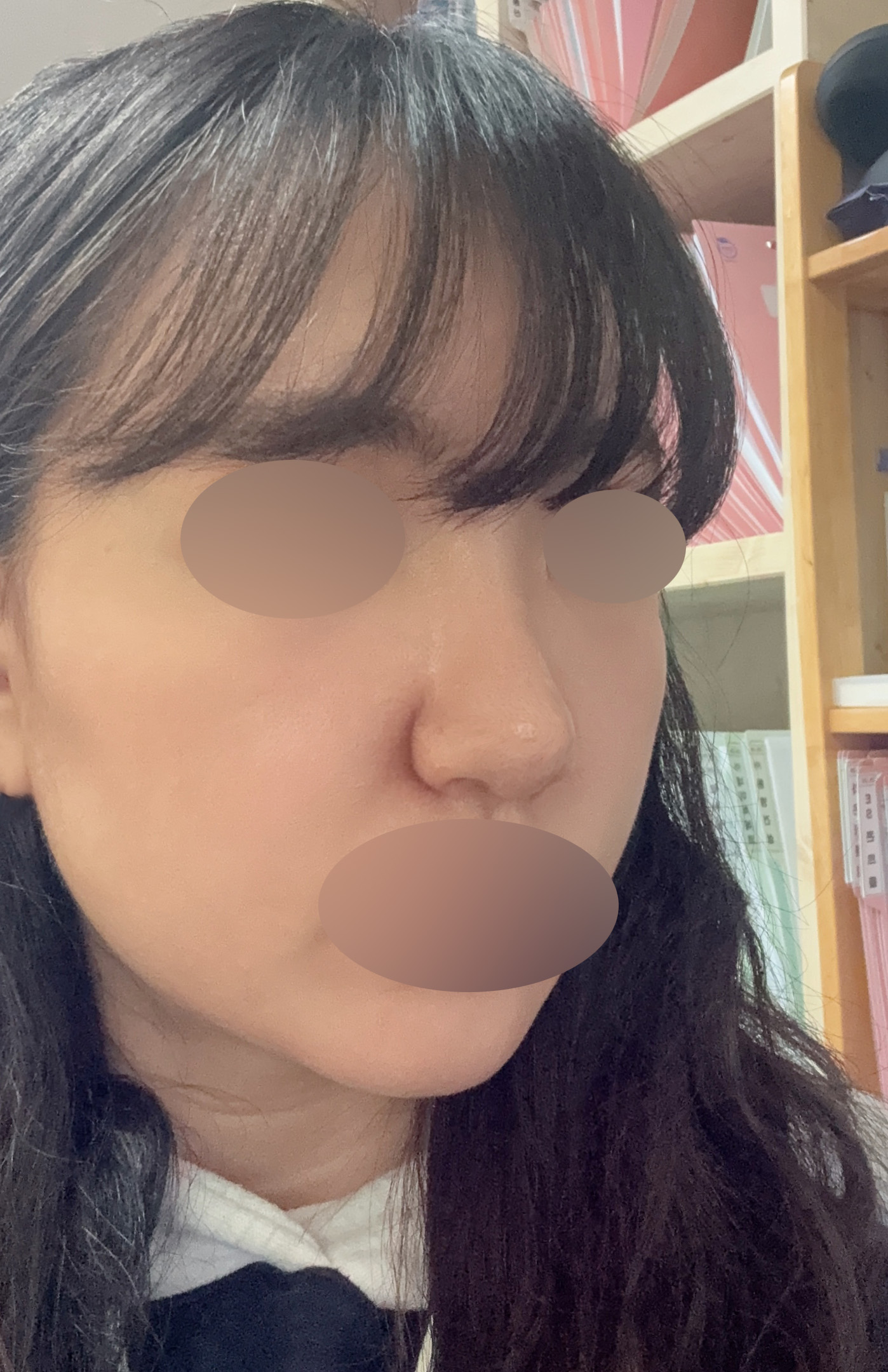 수술후기이미지