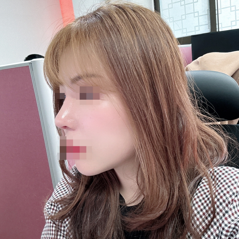 수술후기이미지