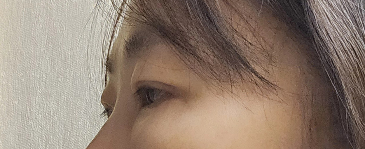 수술후기이미지