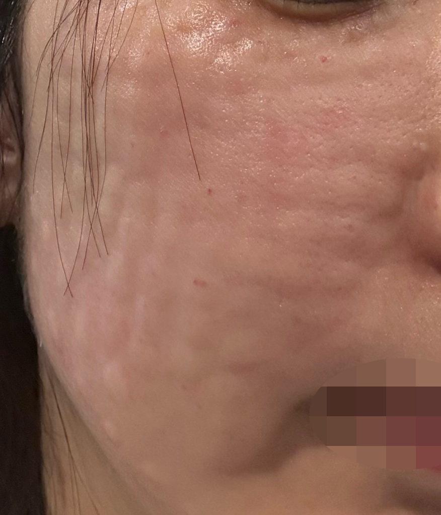 수술후기이미지