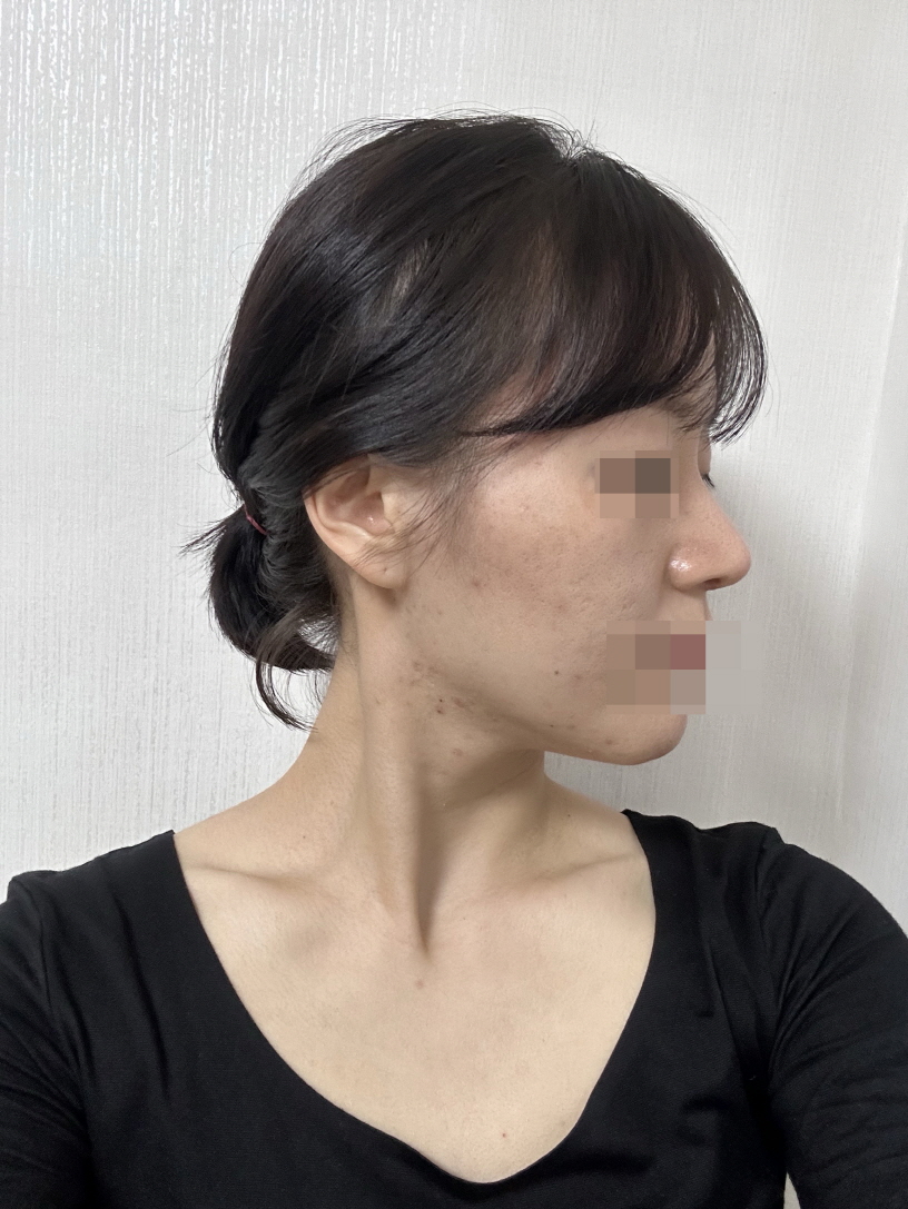 수술후기이미지