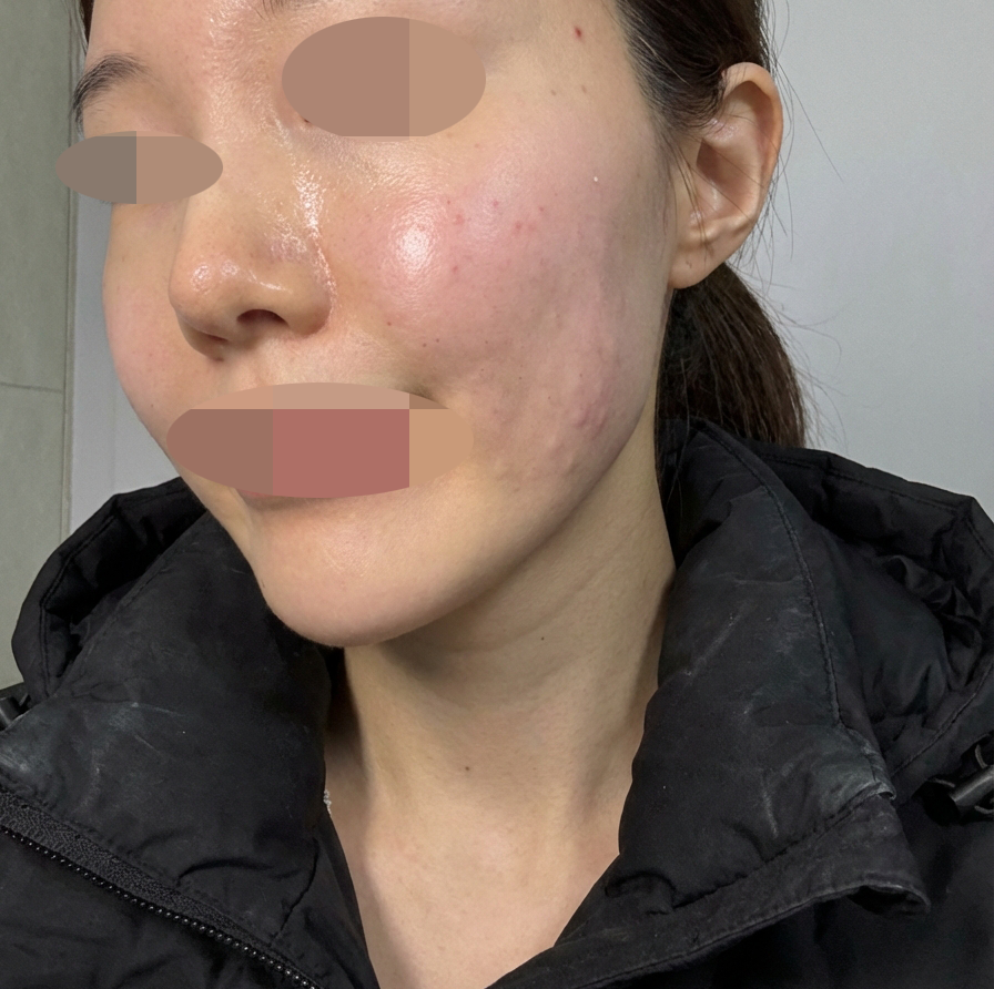 수술후기이미지