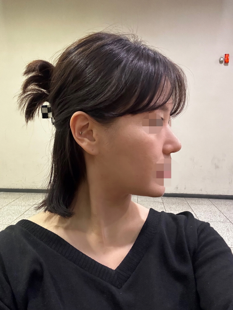 수술후기이미지