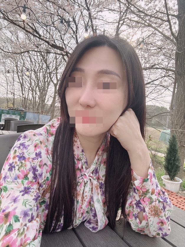 수술후기이미지