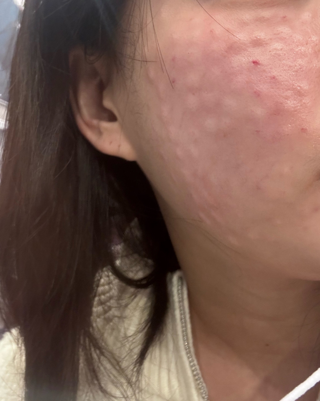 수술후기이미지