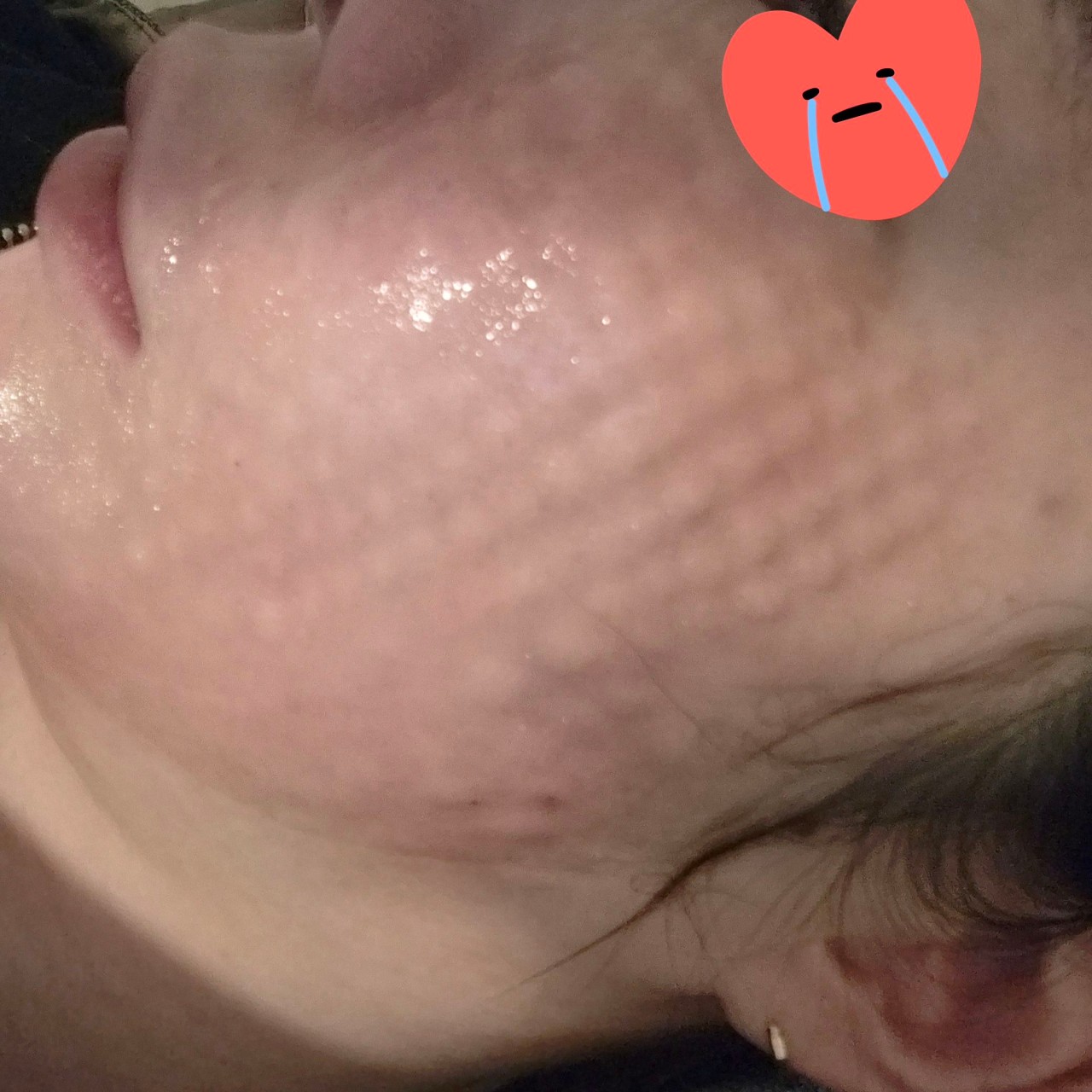 수술후기이미지