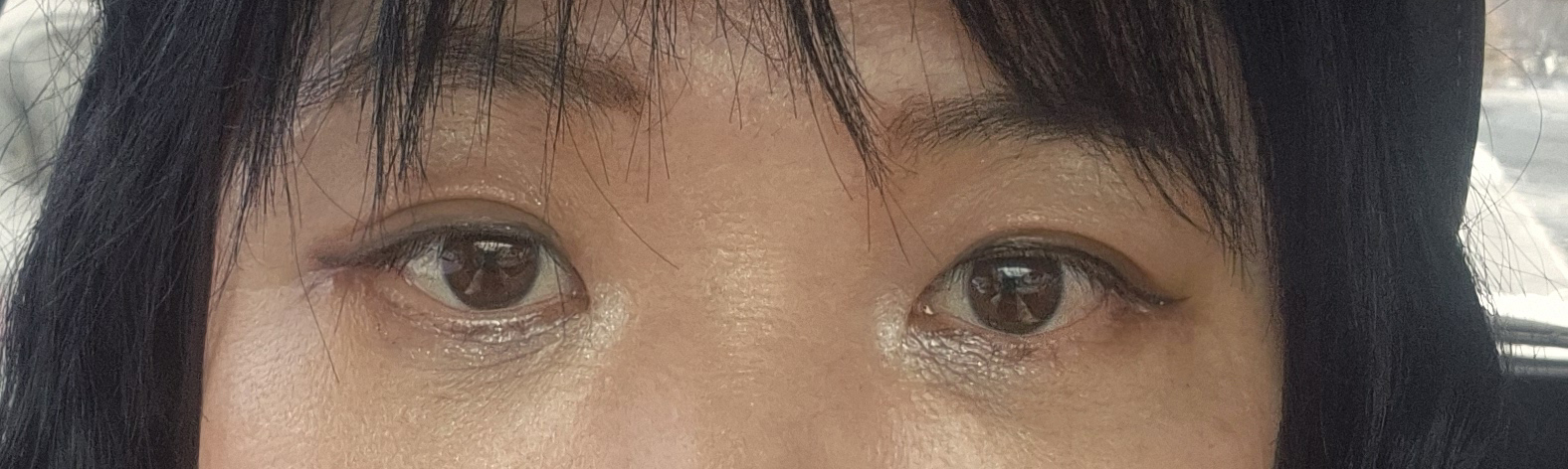 수술후기이미지
