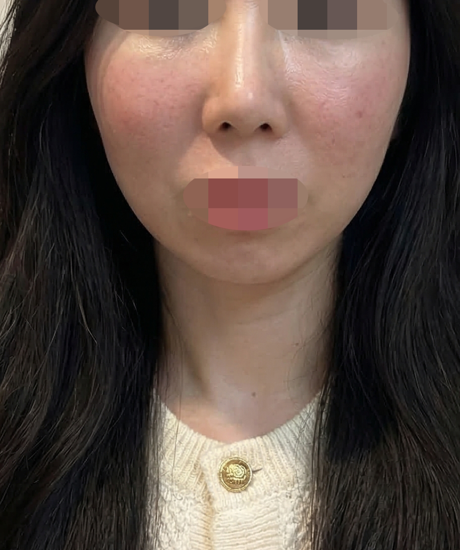 수술후기이미지