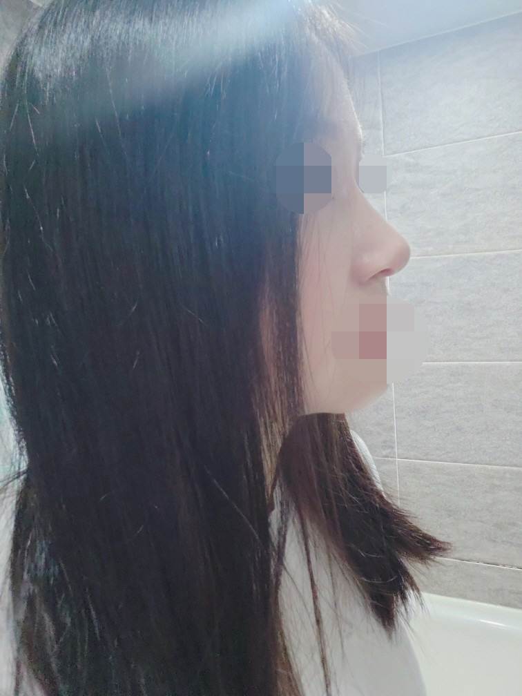 수술후기이미지