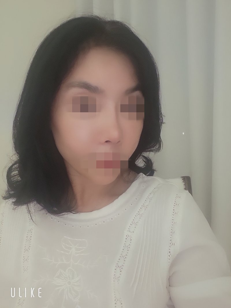 수술후기이미지