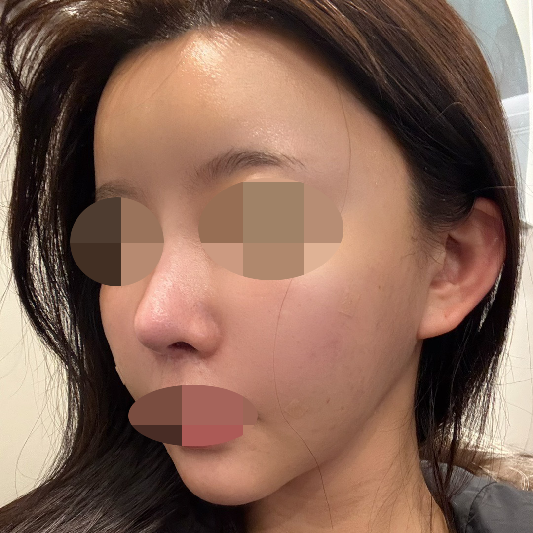 수술후기이미지