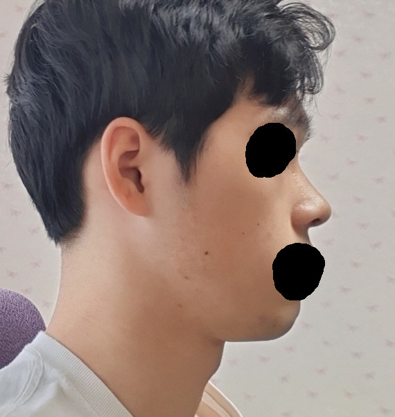 수술후기이미지