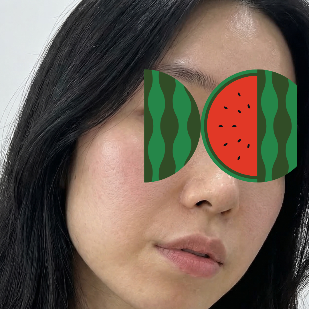 수술후기이미지