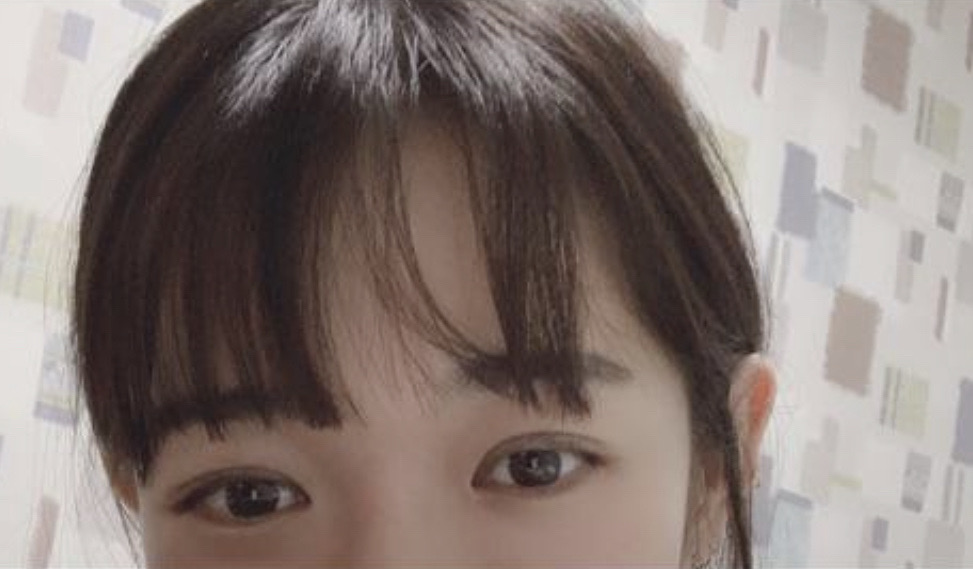 수술후기이미지