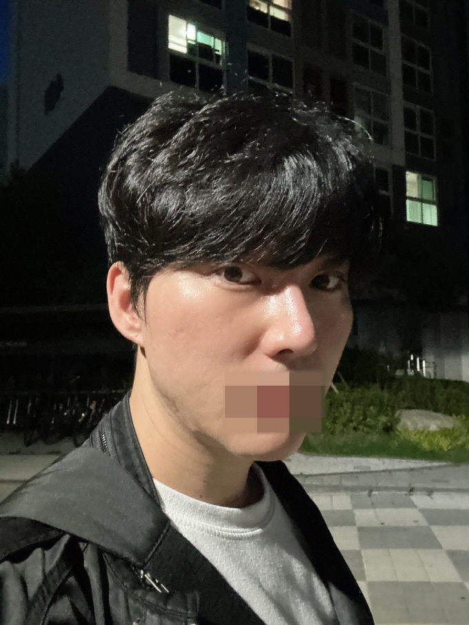 수술후기이미지