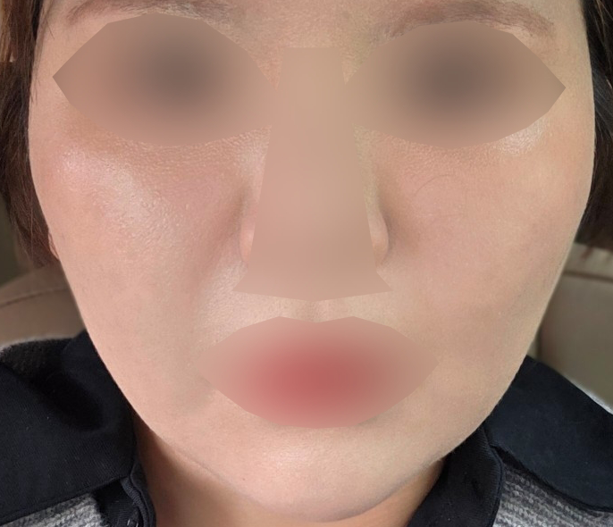 수술후기이미지