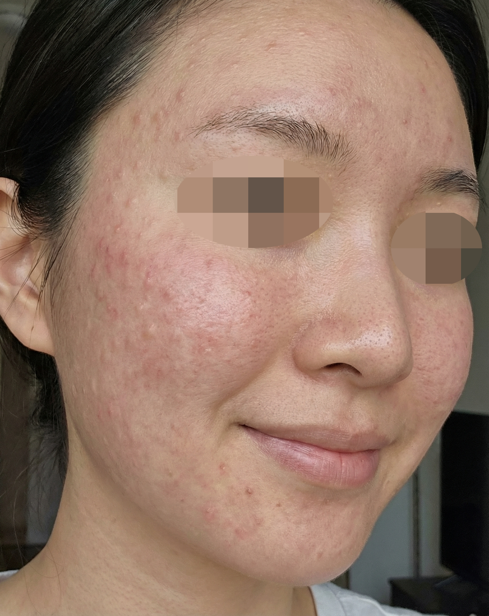 수술후기이미지