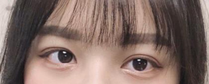 수술후기이미지