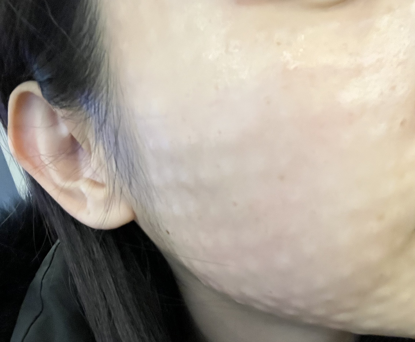 수술후기이미지