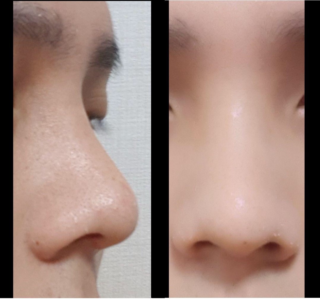 수술후기이미지