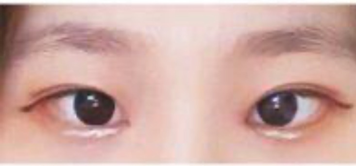 수술후기이미지