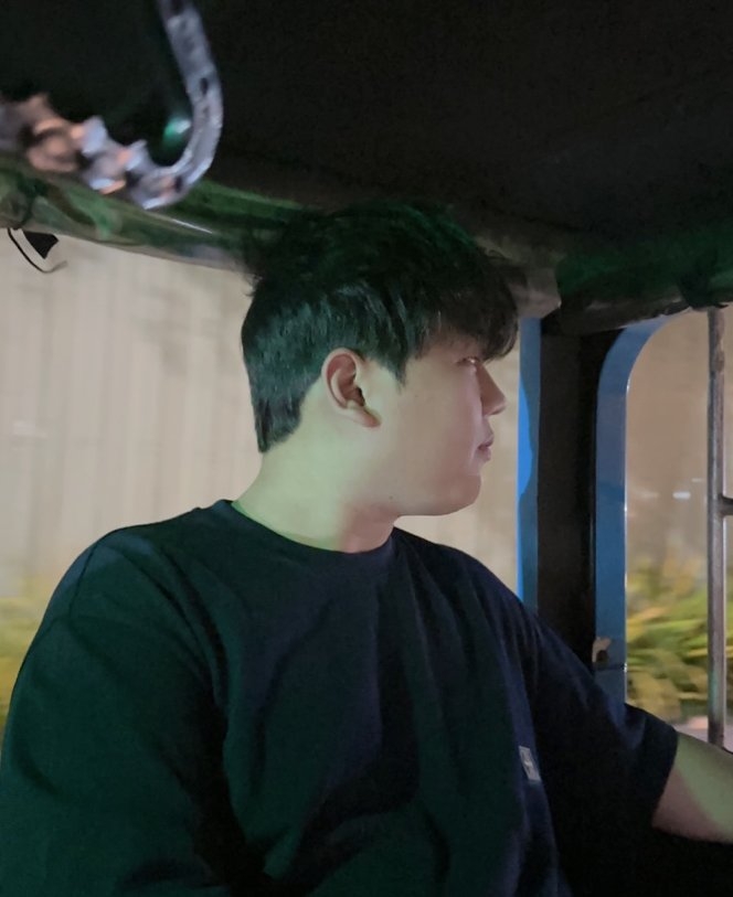 수술후기이미지