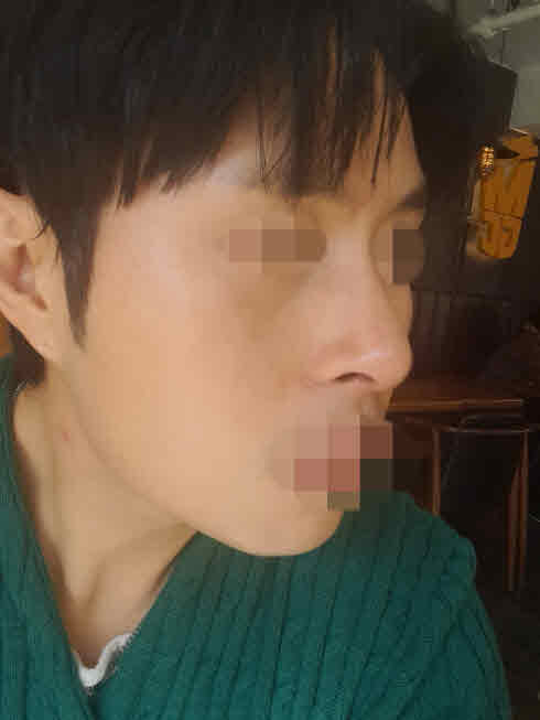 수술후기이미지