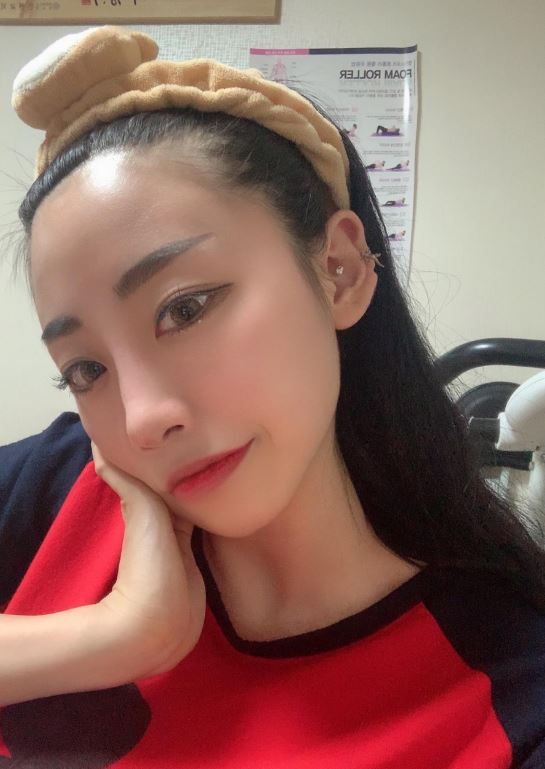 수술후기이미지