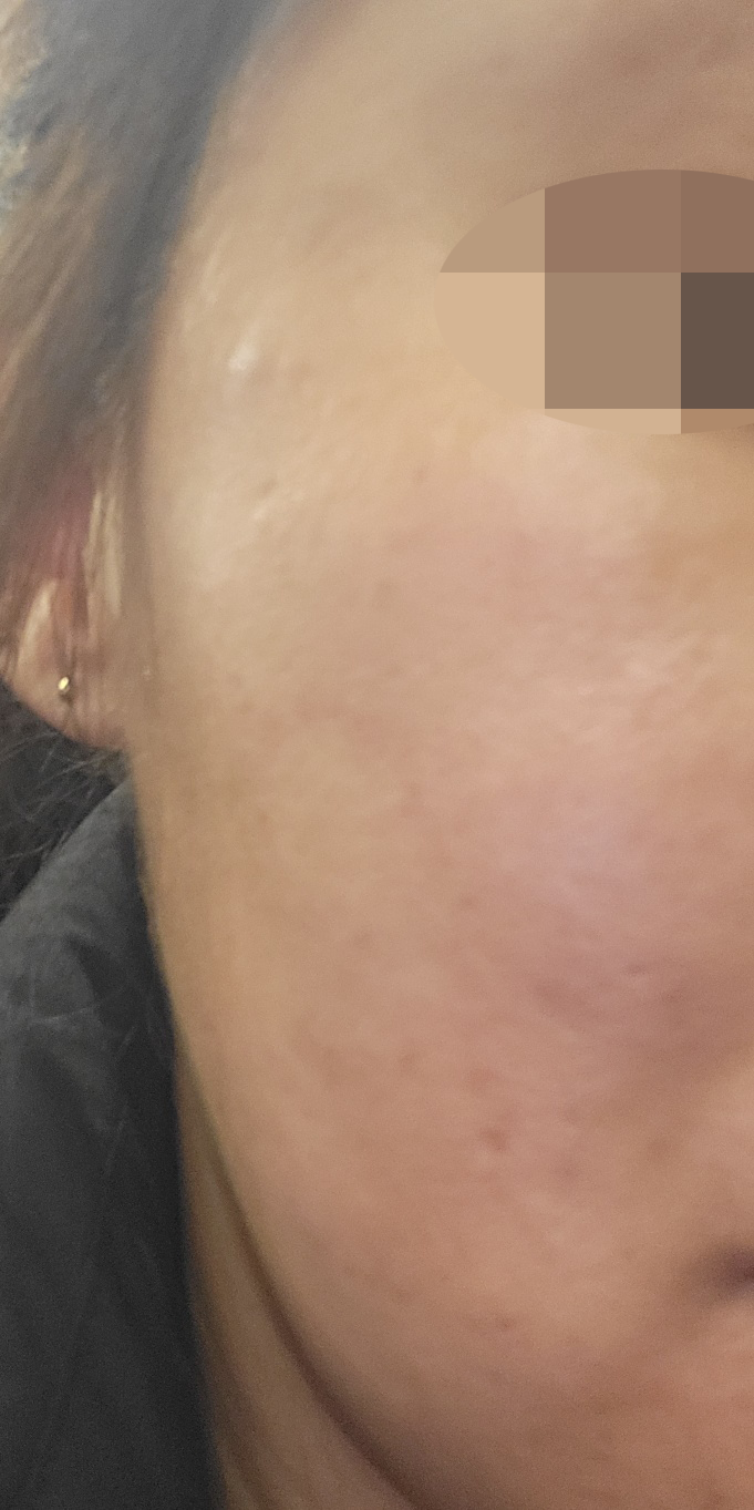 수술후기이미지