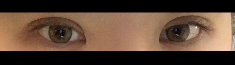 수술후기이미지