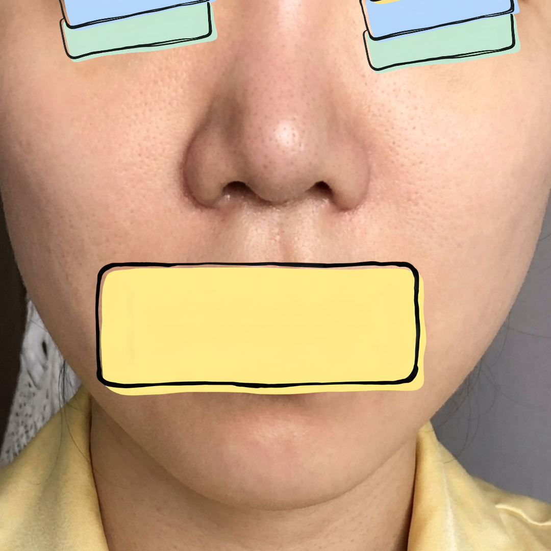 수술후기이미지