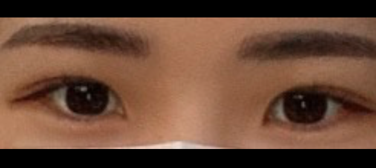 수술후기이미지