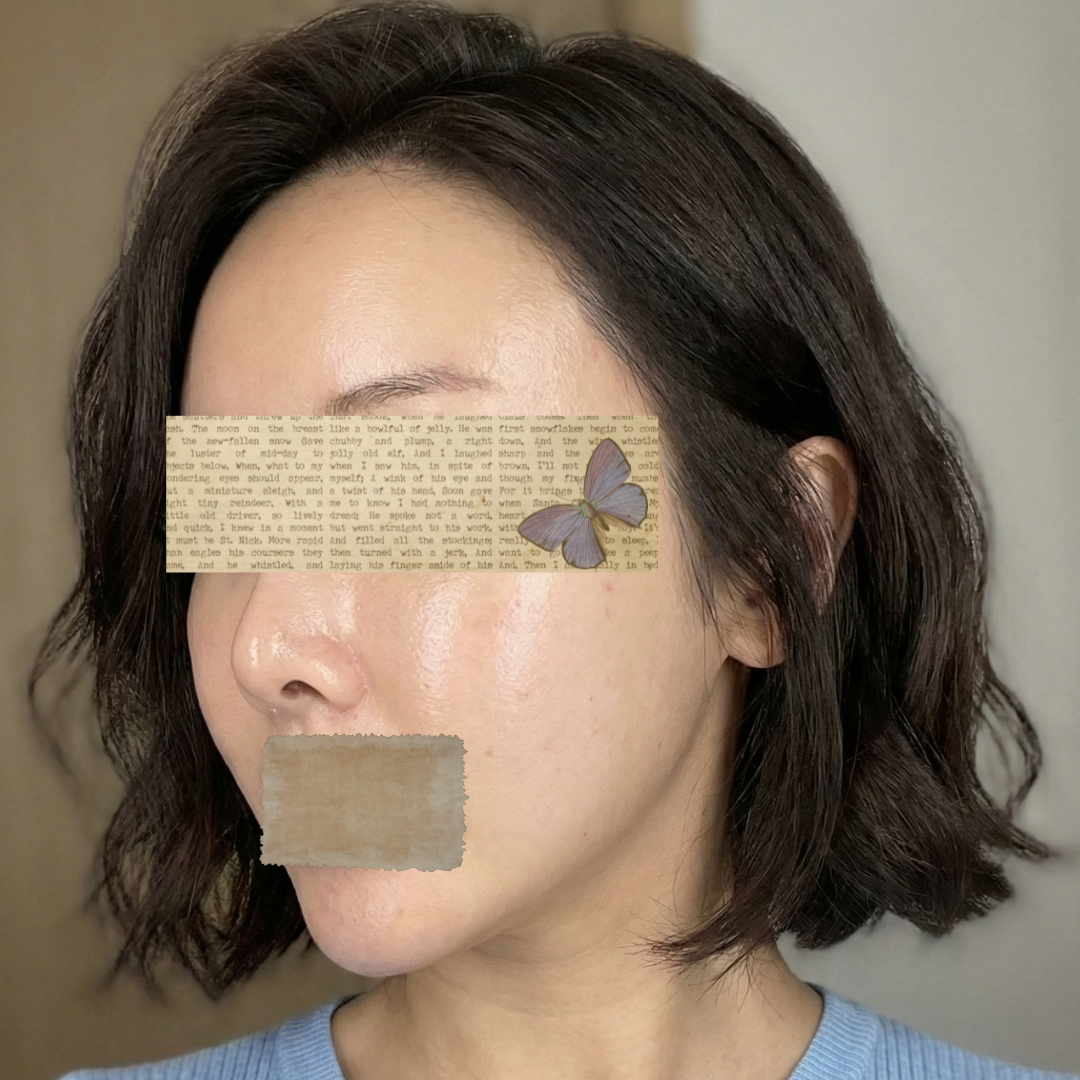 수술후기이미지