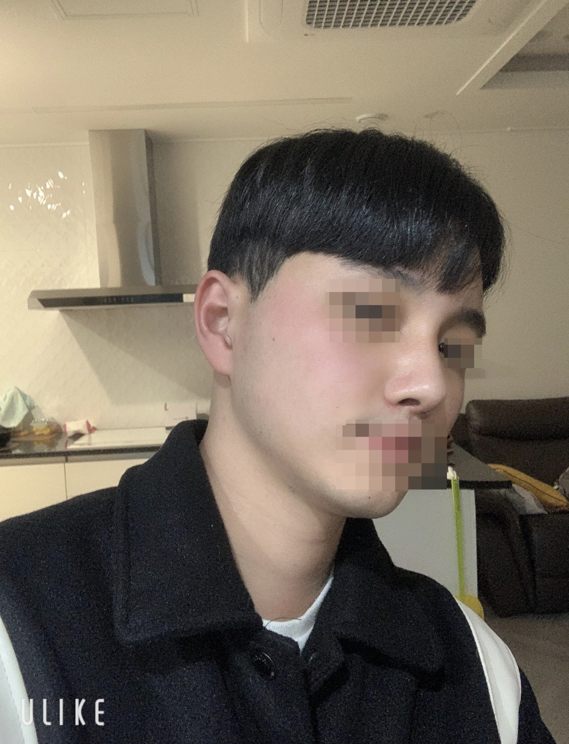 수술후기이미지