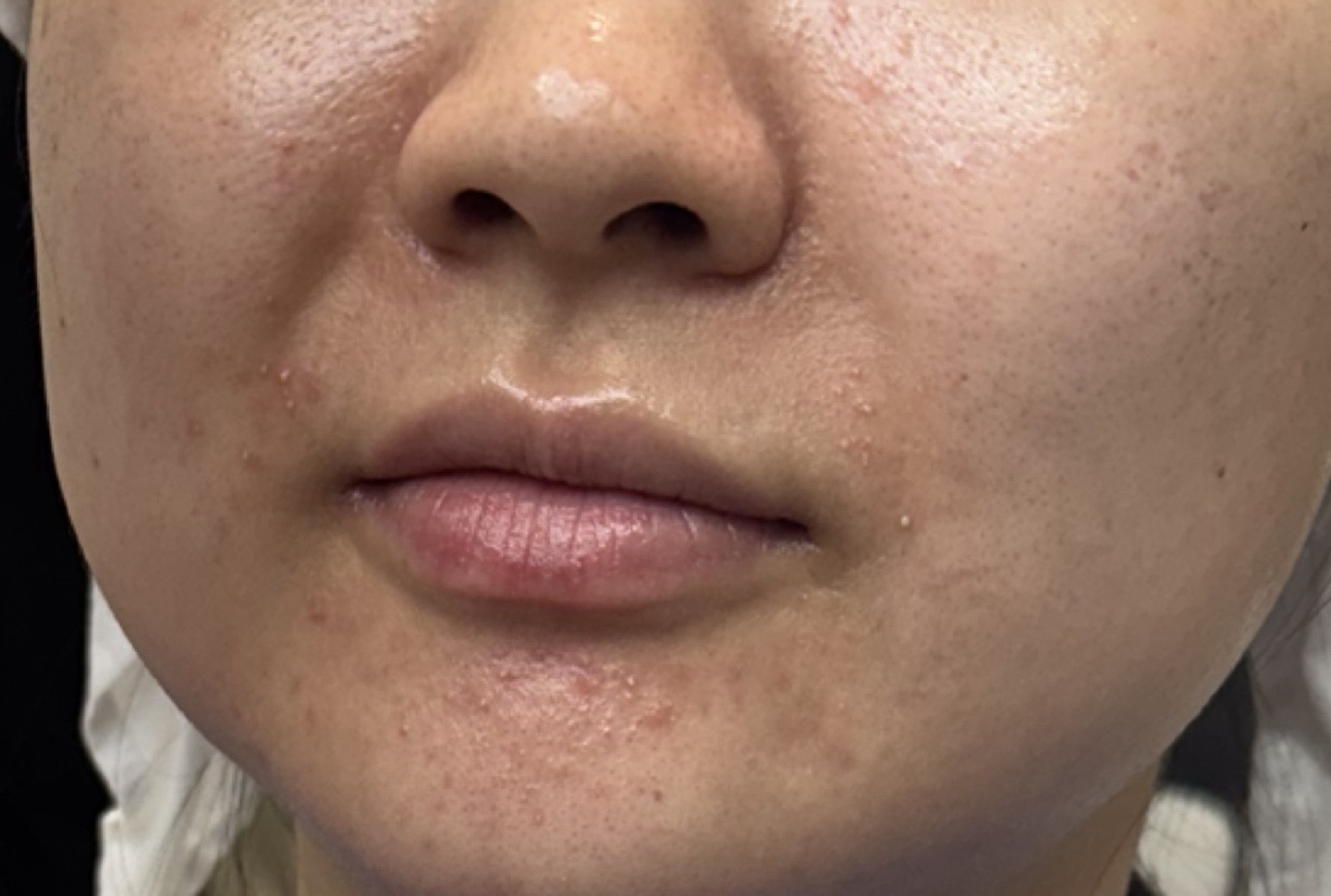 수술후기이미지