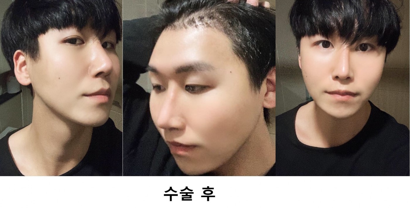 수술후기이미지