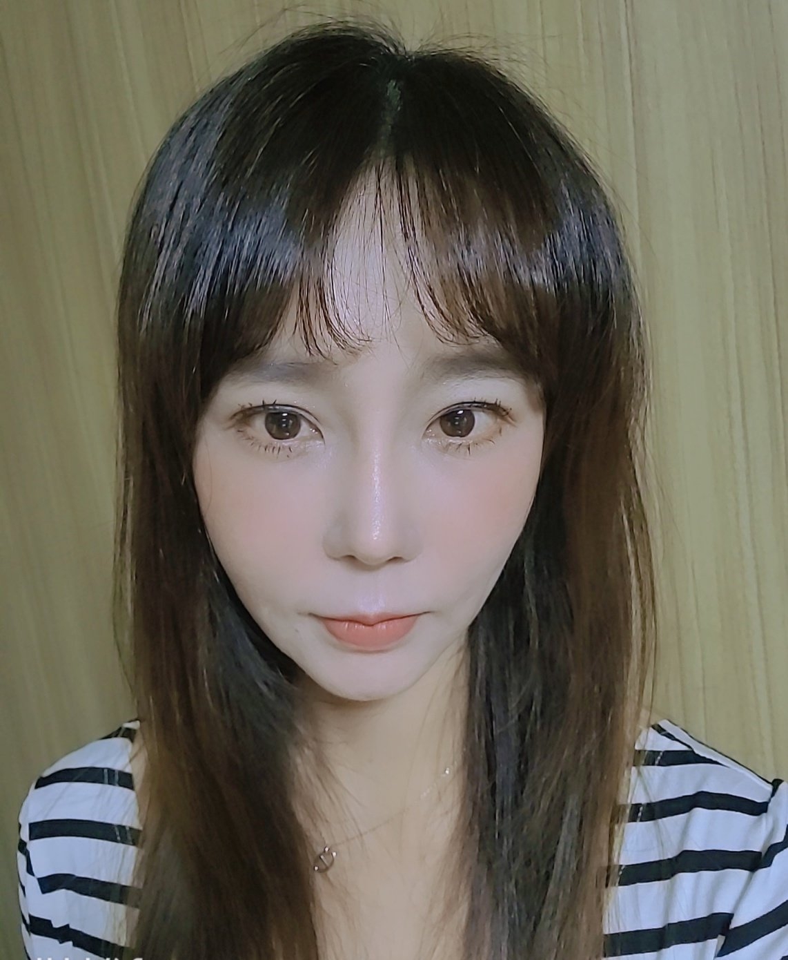 수술후기이미지