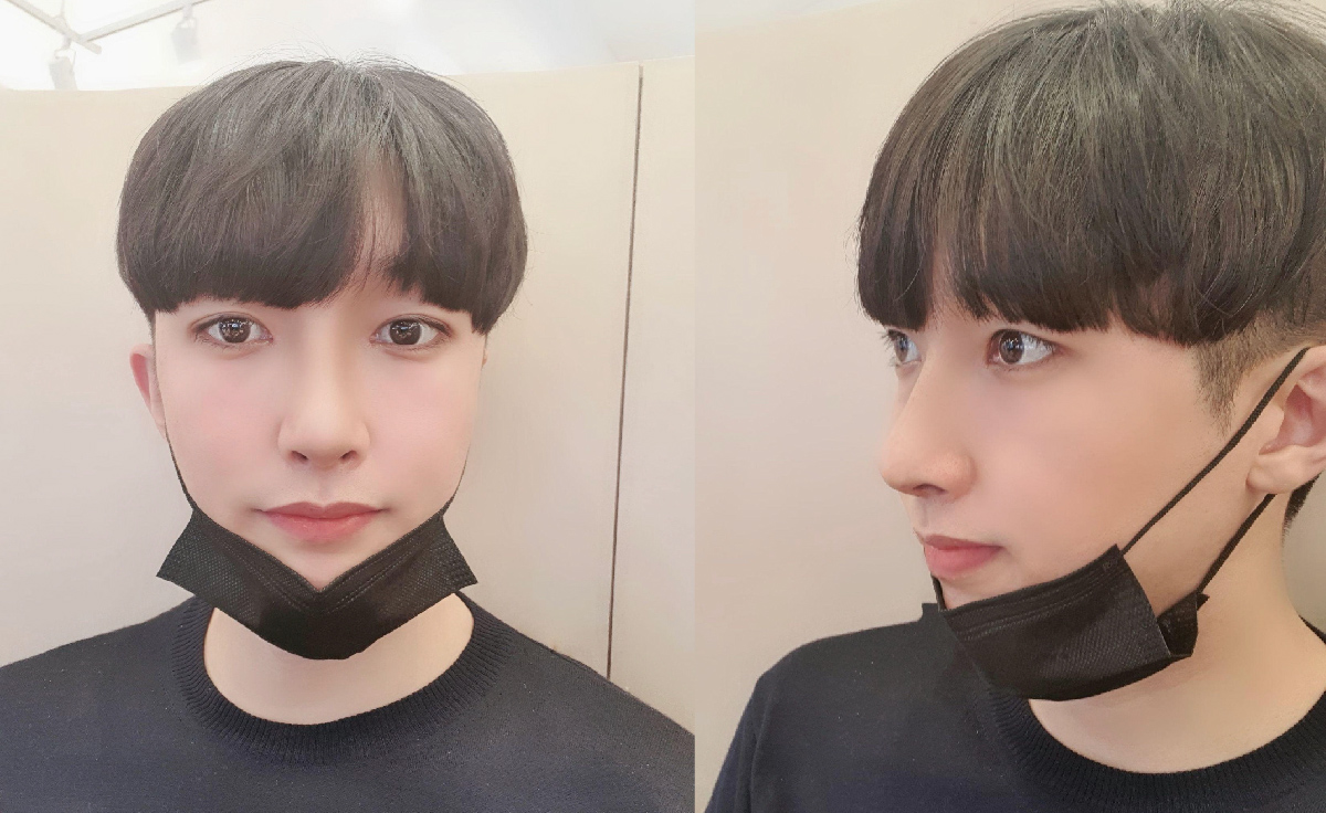 수술후기이미지